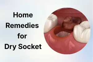 Home Remedies for Dry Socket: Ways to Relieve Pain and Heal