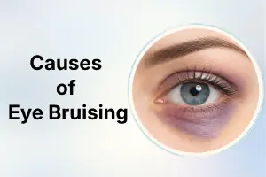 Causes of Eye Bruising: Common Causes and When to See a Doctor