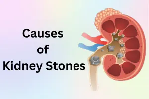 Causes of Kidney Stones: Main Triggers, Risks & Prevention Guide