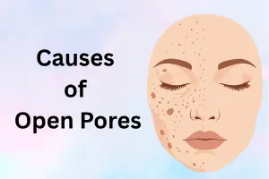 Causes of Open Pores on Face: Reveal the Real Reasons