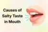 Causes of Salty Taste in the Mouth: Find Out Why It Occurs - Post Thumbnail