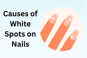 Causes of White Spots on Nails: Is It a Sign of Something Serious?
