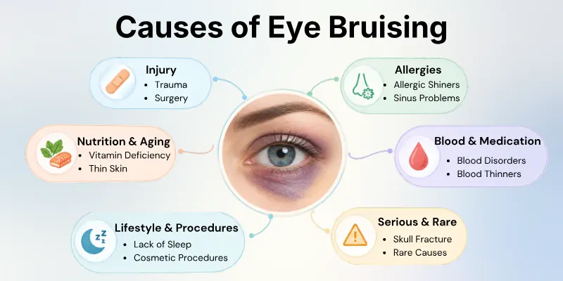 Common Causes of Eye Bruising