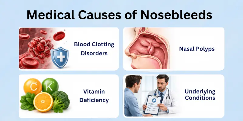 Common Medical Causes of Nosebleeds