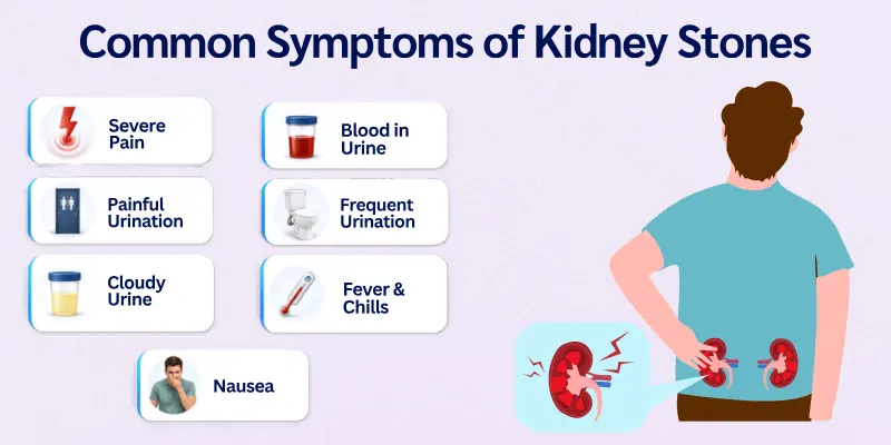 Common symptoms of Kidney Stones