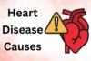 What Causes Heart Disease & How to Prevent It: Act Now!  - Post Thumbnail