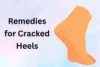 Home Remedies for Cracked Heels: Easy Ways to Heal Fast - Post Thumbnail