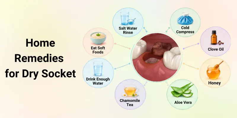 Home Remedies for Dry Socket