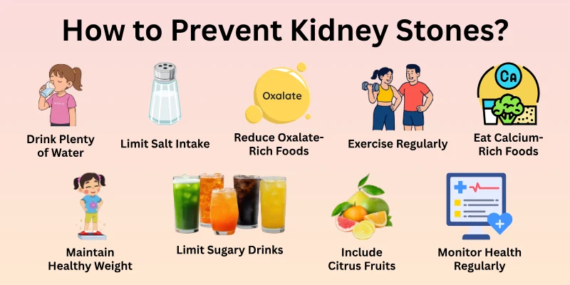 How to Prevent Kidney Stones?