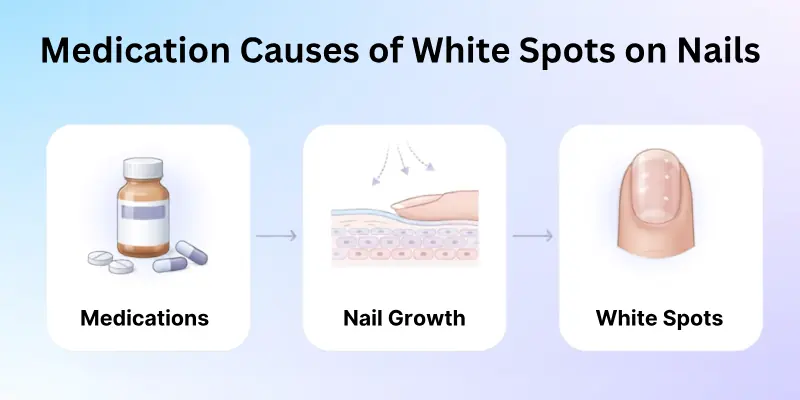 Medicines' Causes of White Spot on Nails