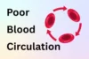 Symptoms of Poor Blood Circulation You Should Never Ignore - Post Thumbnail