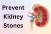 How to Prevent Kidney Stones: Natural and Proven Ways - Post Thumbnail