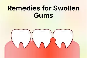 Home Remedies for Swollen Gums: Simple Ways to Get Relief