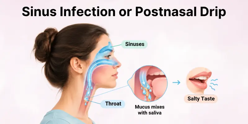 Sinus Infection or Postnasal Drip