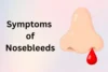 Common Symptoms of Nosebleeds and When to Seek Help - Post Thumbnail