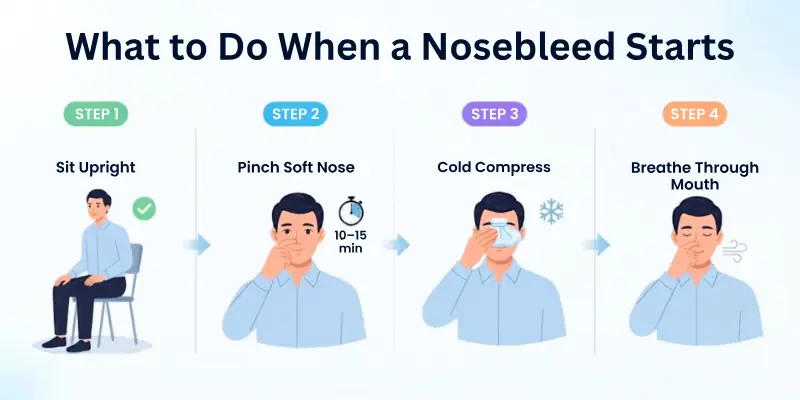 What to Do Immediately When a Nosebleed Starts